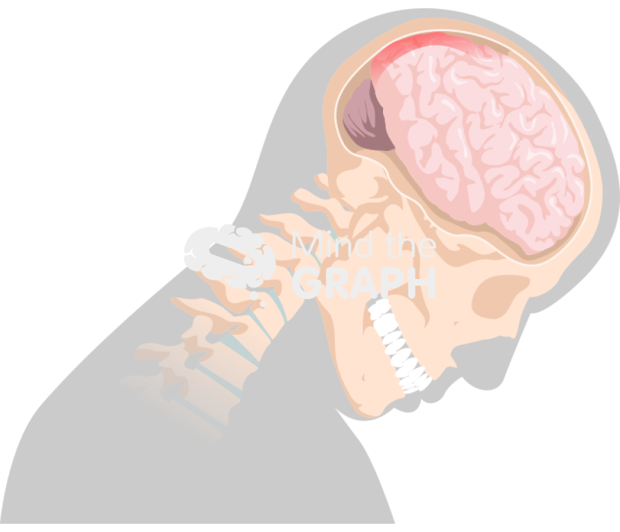 Head movement diffuse axonal injury 3 Icons, Symbols, Pictures, and Images