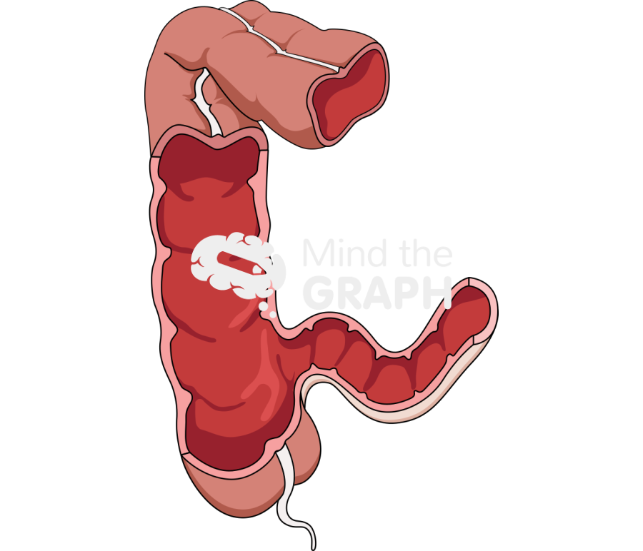 Healthy colon Icons, Symbols, Pictures, and Images