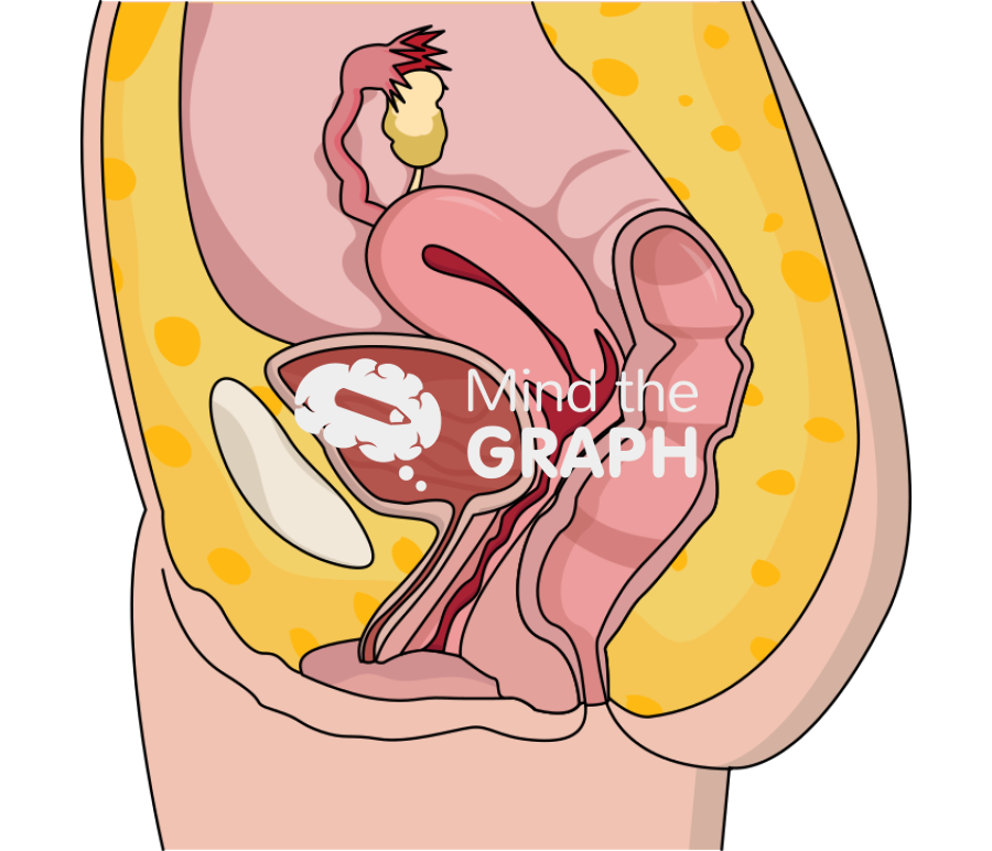 Healthy uterus Icons, Symbols, Pictures, and Images