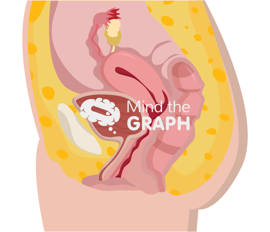 Healthy uterus Icons, Symbols, Pictures, and Images