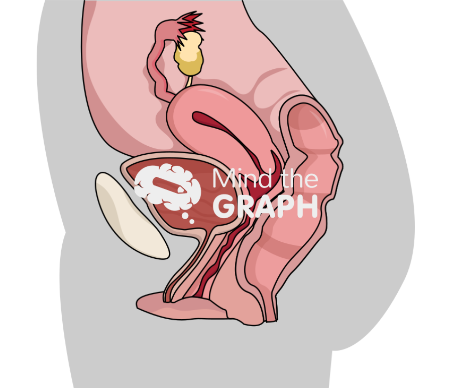Healthy uterus body Icons, Symbols, Pictures, and Images