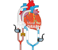 Heart extracorporeal membrane oxygenation Icons, Symbols, Pictures, and Images