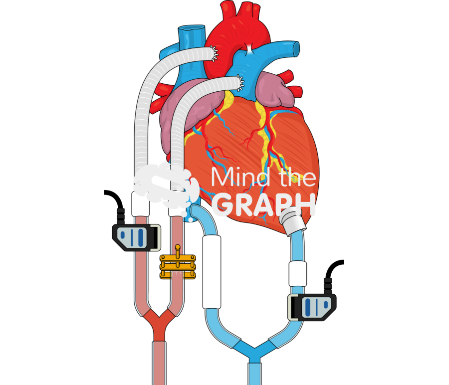 Heart extracorporeal membrane oxygenation Icons, Symbols, Pictures, and Images