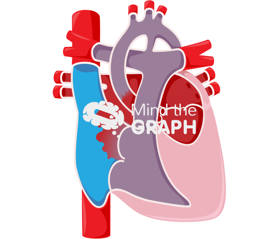 Heart hypoplastic left heart syndrom Icons, Symbols, Pictures, and Images