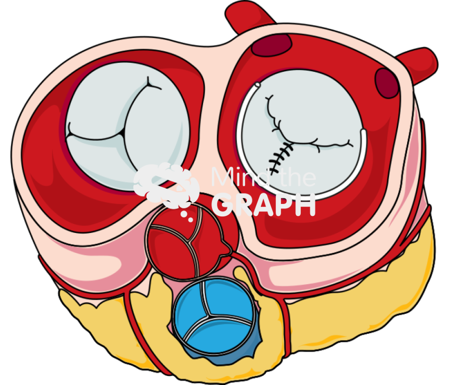 Heart section annuloplasty Icons, Symbols, Pictures, and Images