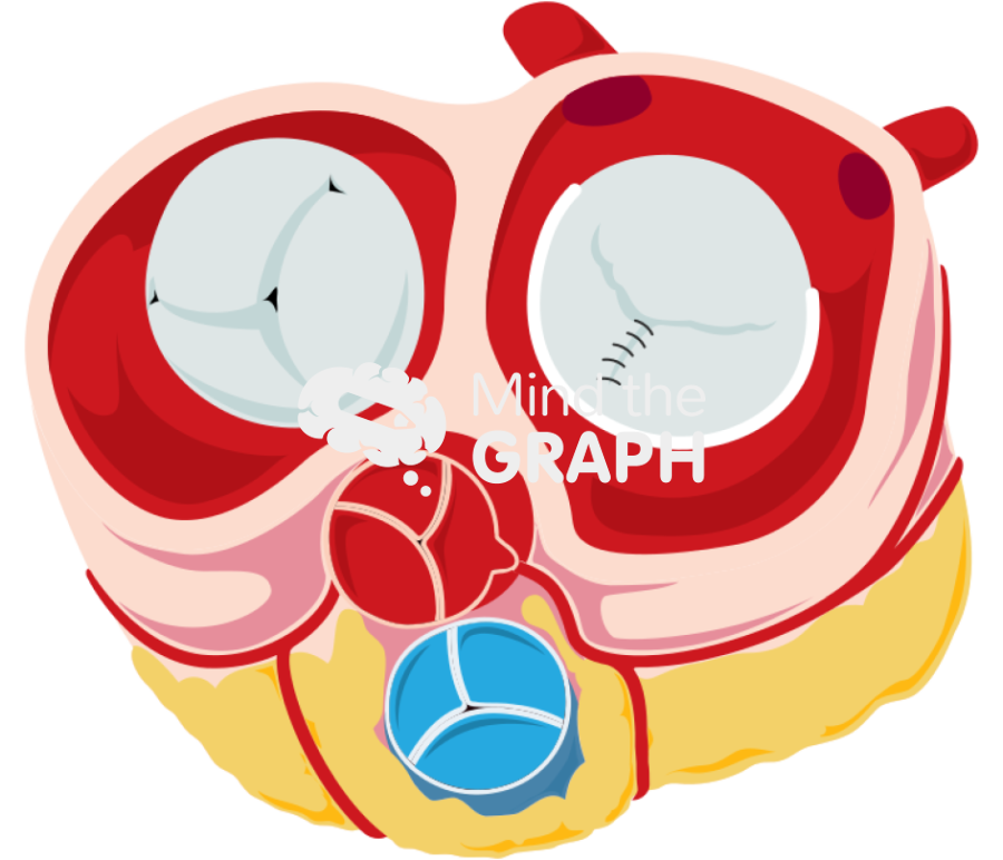 Heart section annuloplasty Icons, Symbols, Pictures, and Images