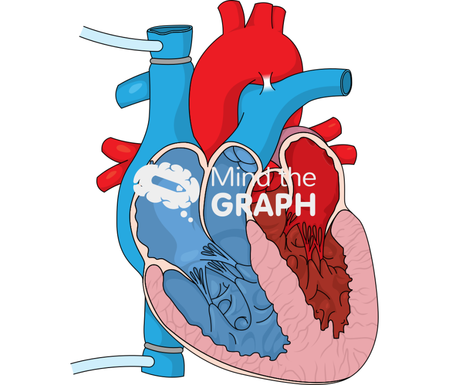 Heart surgery cardiac bypass front cut Icons, Symbols, Pictures, and Images
