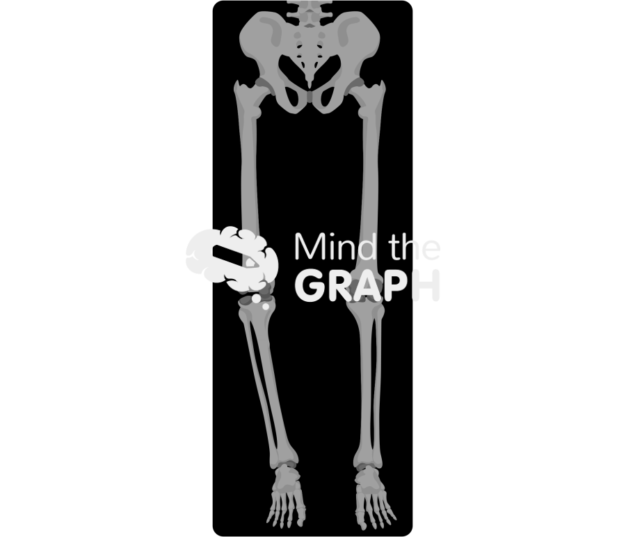 High tibial osteotomy alignment x ray Icons, Symbols, Pictures, and Images