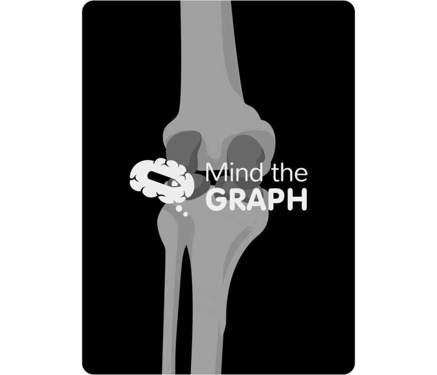 High tibial osteotomy anterior posterior x ray Icons, Symbols, Pictures, and Images