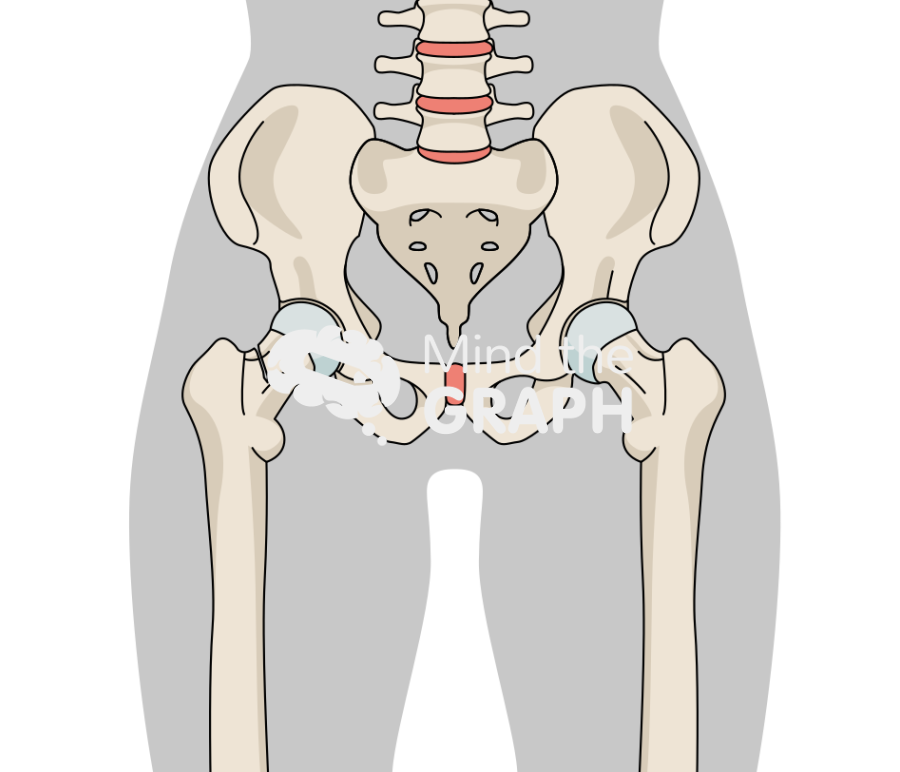 Hip fracture body Icons, Symbols, Pictures, and Images