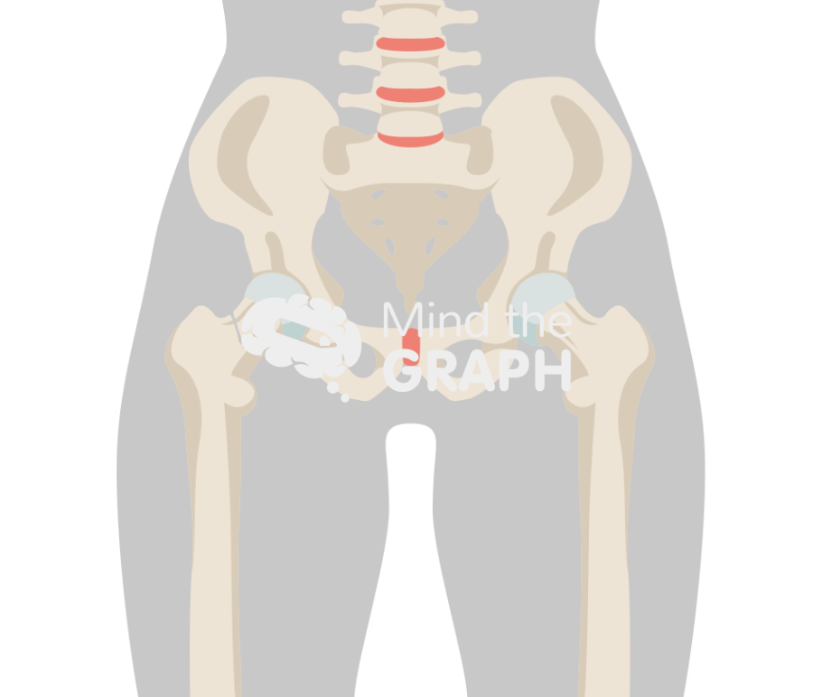 Hip fracture body Icons, Symbols, Pictures, and Images