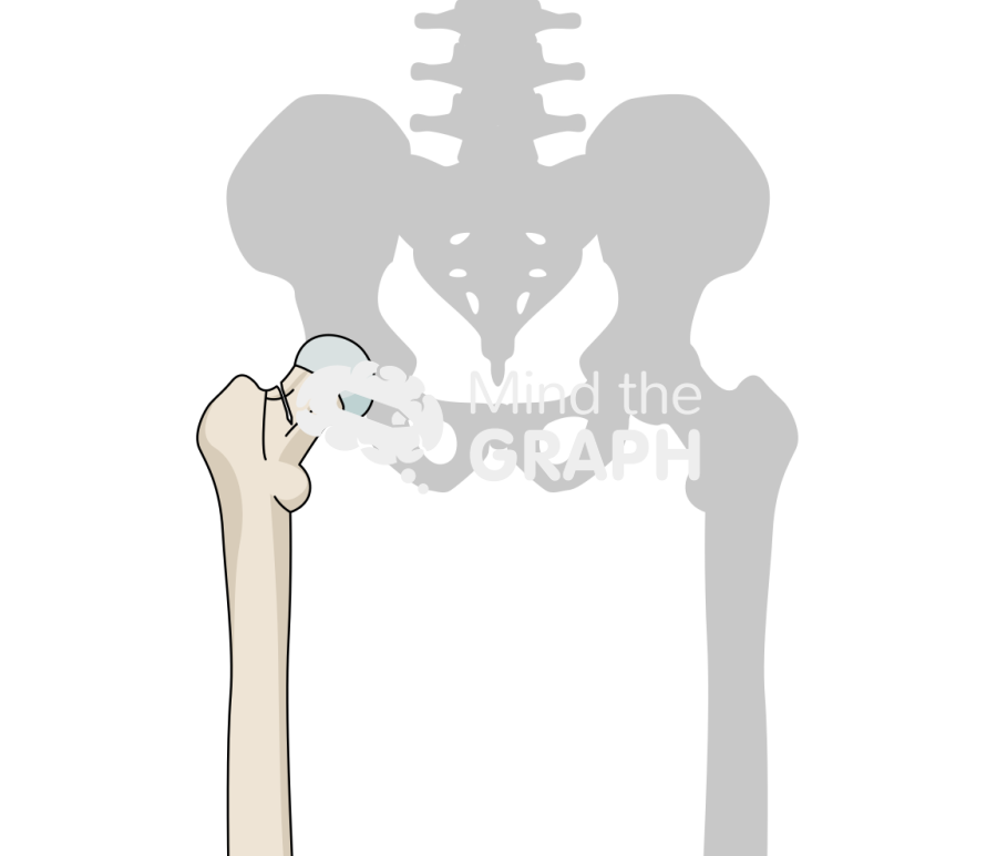 Hip fracture bone Icons, Symbols, Pictures, and Images