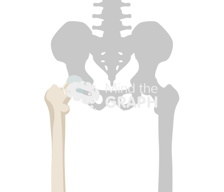 Hip fracture bone Icons, Symbols, Pictures, and Images