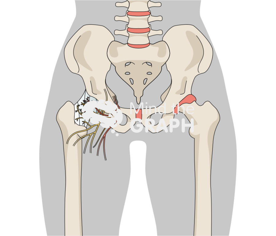 Hip joint innervation front Icons, Symbols, Pictures, and Images