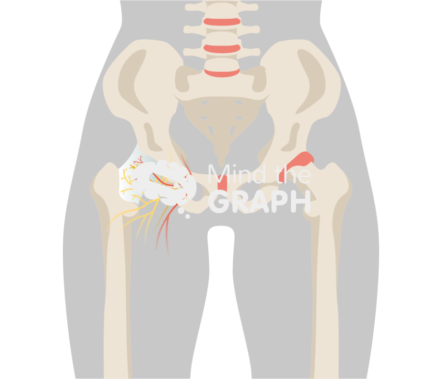 Hip joint innervation front Icons, Symbols, Pictures, and Images