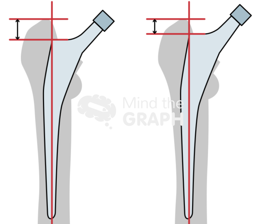 Hip stem subsidence bone Icons, Symbols, Pictures, and Images