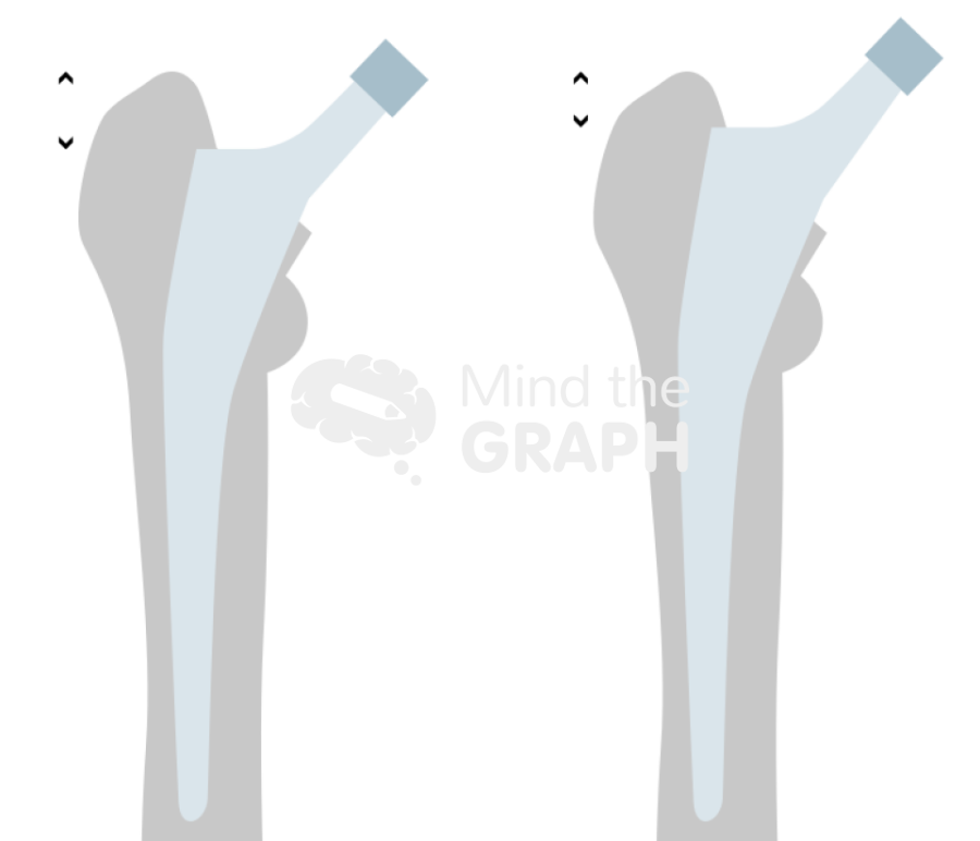 Hip stem subsidence bone Icons, Symbols, Pictures, and Images