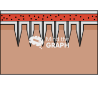 Hollow microneedles tissue 1 Icons, Symbols, Pictures, and Images