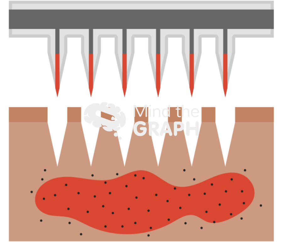 Hollow microneedles tissue 3 Icons, Symbols, Pictures, and Images