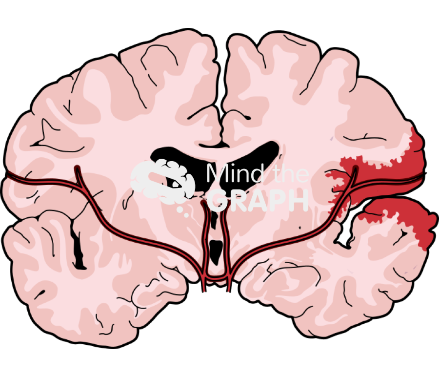 Human brain blood injury front cut 1 Icons, Symbols, Pictures, and Images