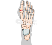 Human foot bones gouty arthritis shape superior Icons, Symbols, Pictures, and Images
