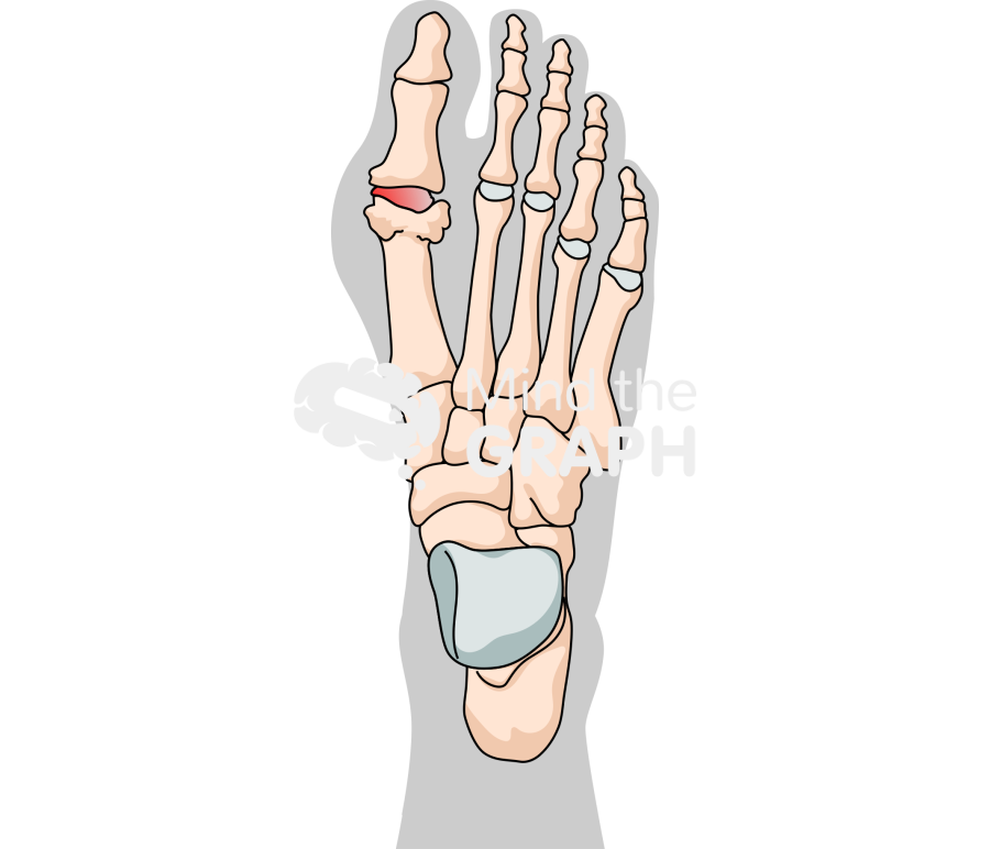 Human foot bones gouty arthritis shape superior Icons, Symbols, Pictures, and Images