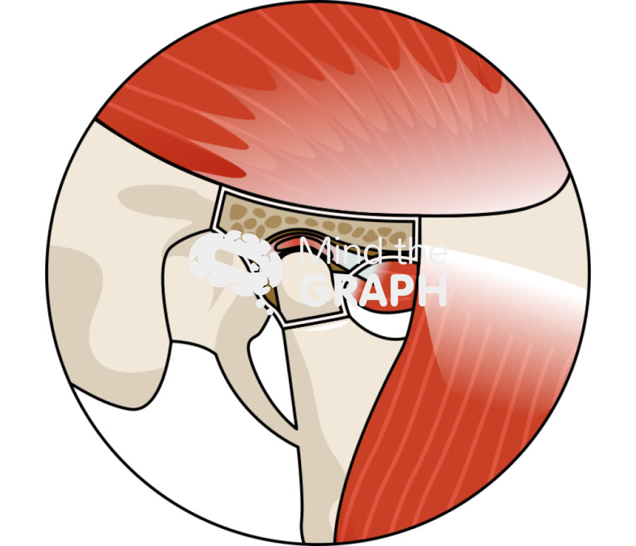 Human inflammed temporomandibular joint side zoom Icons, Symbols, Pictures, and Images