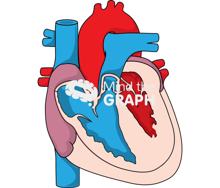 Hypertrophic cardiomyopathy Icons, Symbols, Pictures, and Images