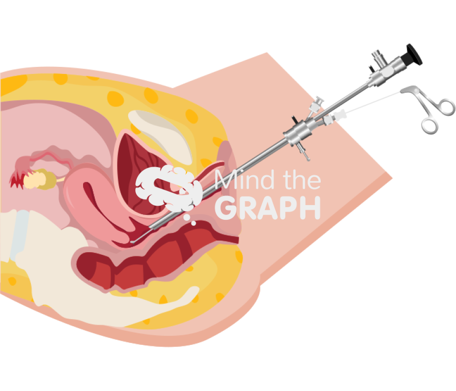 Hysteroscopy reproductive system longitudinal cut Icons, Symbols, Pictures, and Images