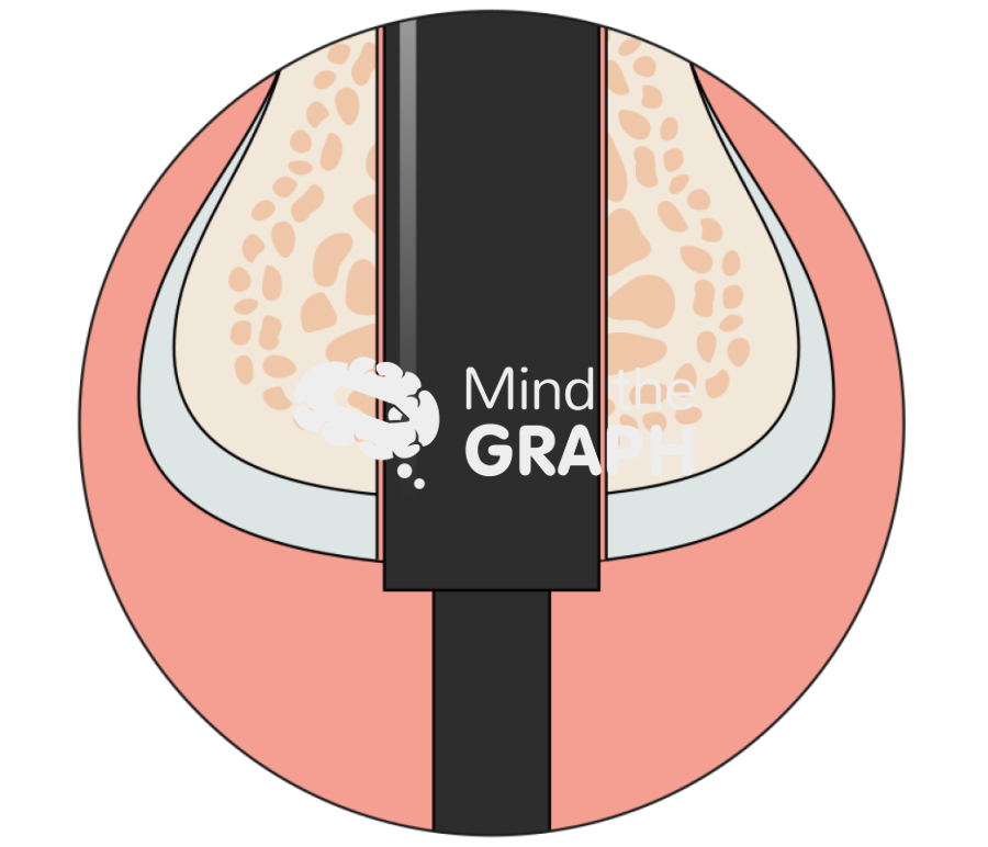 Implant soft tissue Icons, Symbols, Pictures, and Images