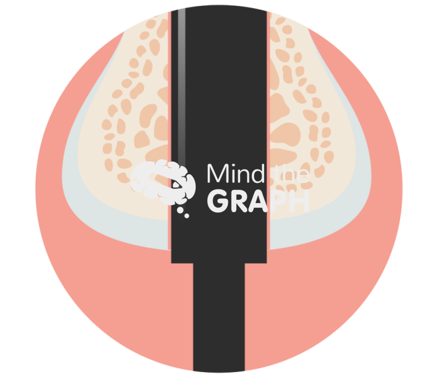 Implant soft tissue Icons, Symbols, Pictures, and Images