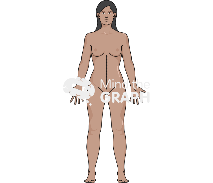 Incisional hernia repair woman Icons, Symbols, Pictures, and Images