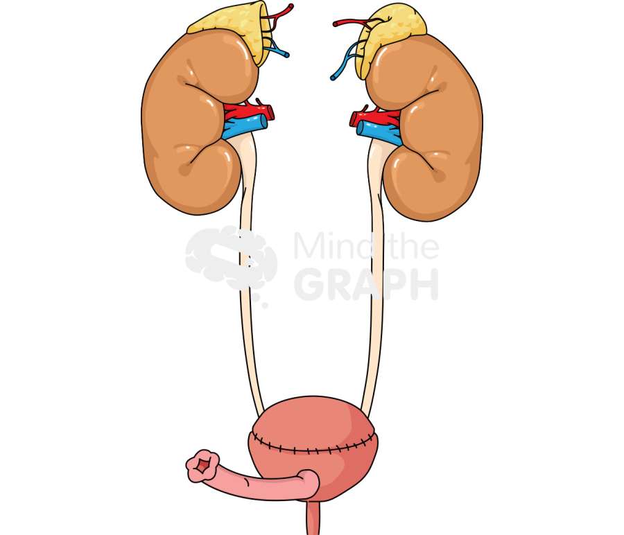 Indiana pouch surgery kidney small intestine Icons, Symbols, Pictures, and Images