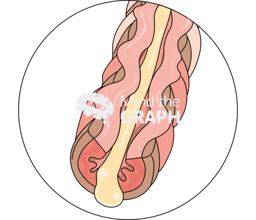 Inflamed airway asthma Icons, Symbols, Pictures, and Images