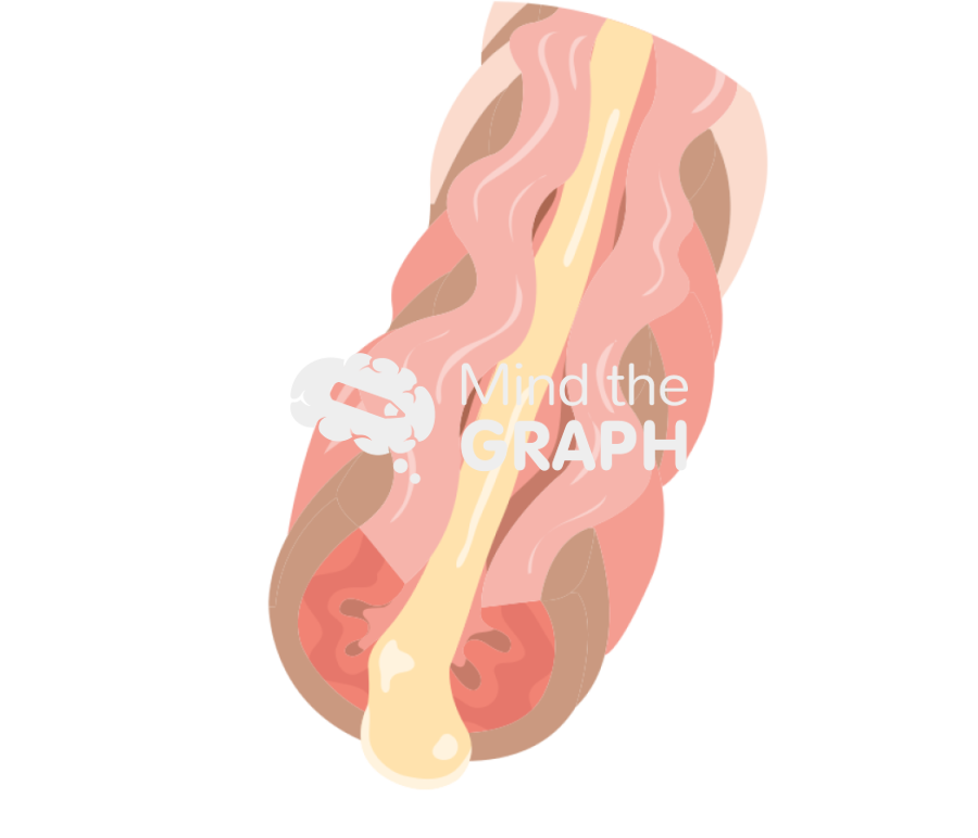 Inflamed airway asthma Icons, Symbols, Pictures, and Images