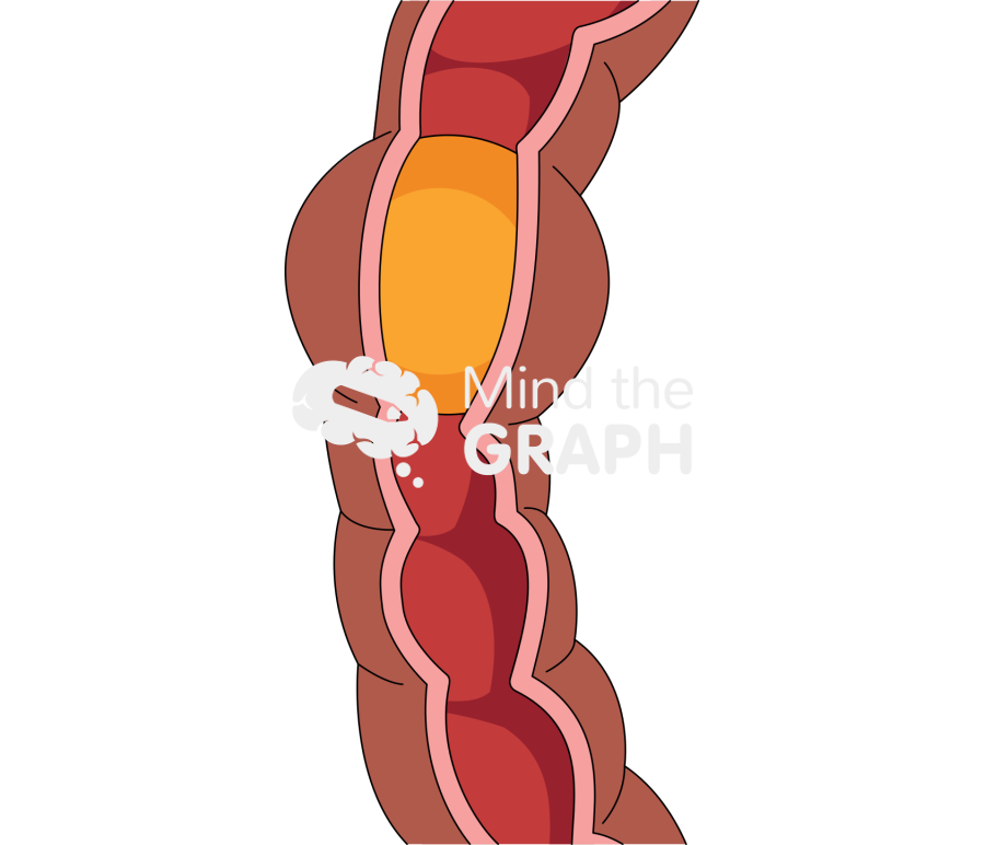 Intestinal food peristalsis 1 Icons, Symbols, Pictures, and Images