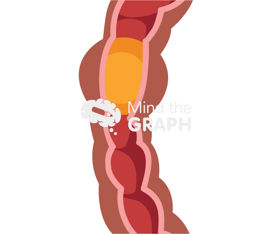 Intestinal food peristalsis 1 Icons, Symbols, Pictures, and Images