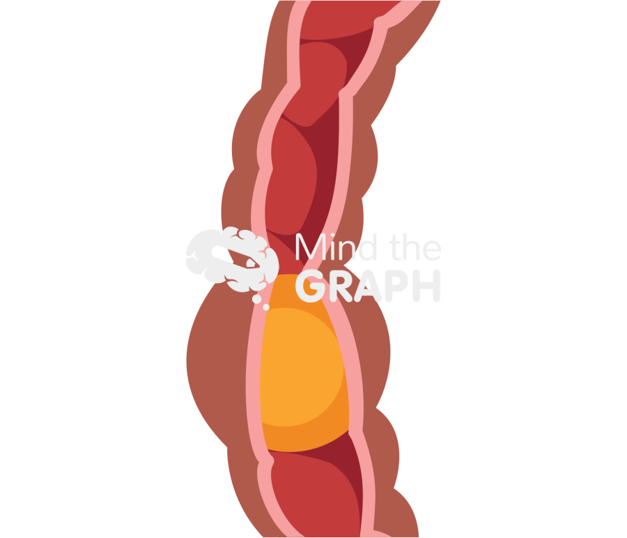 Intestinal food peristalsis 2 Icons, Symbols, Pictures, and Images