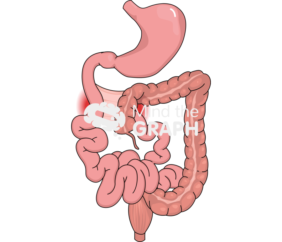 Intestinal malrotation