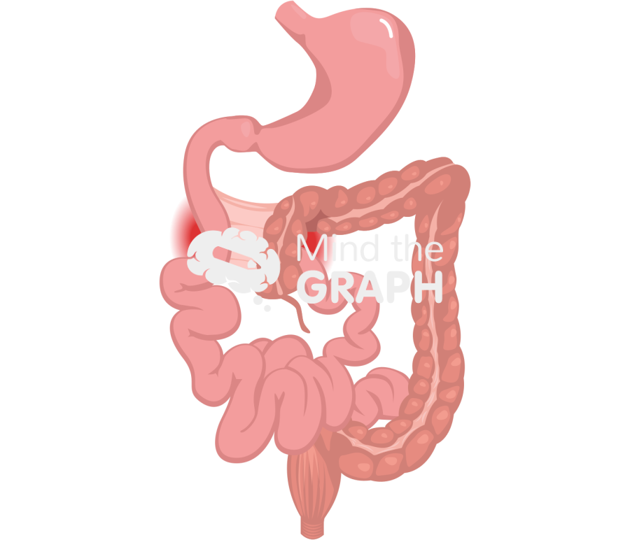 Intestinal malrotation