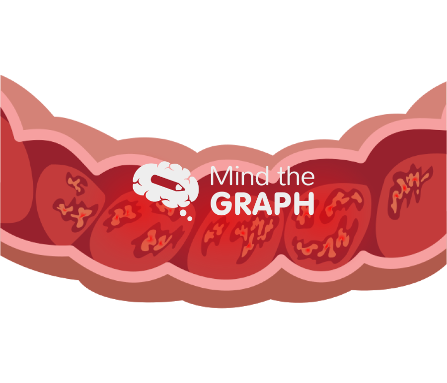 Intestine colitis cut front Icons, Symbols, Pictures, and Images