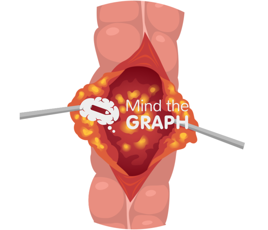 Intestine disease zoom Icons, Symbols, Pictures, and Images