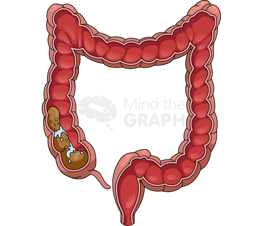 Intestine large cut stool 1 Icons, Symbols, Pictures, and Images