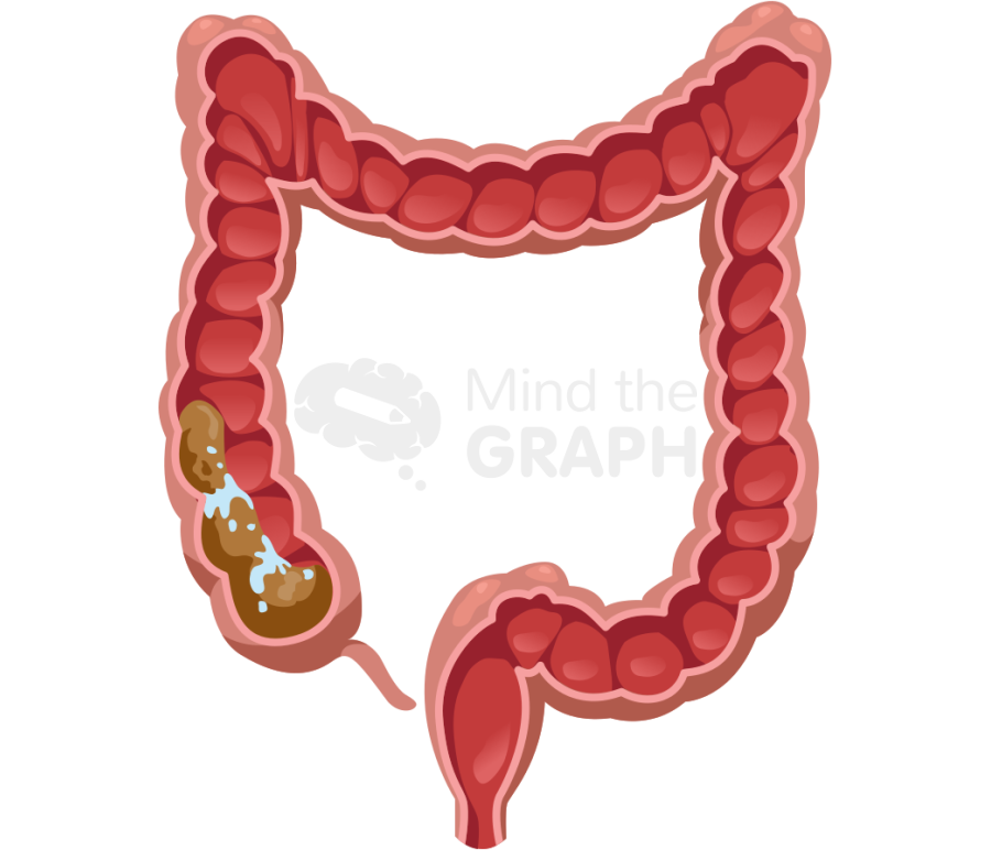 Intestine large cut stool 1 Icons, Symbols, Pictures, and Images