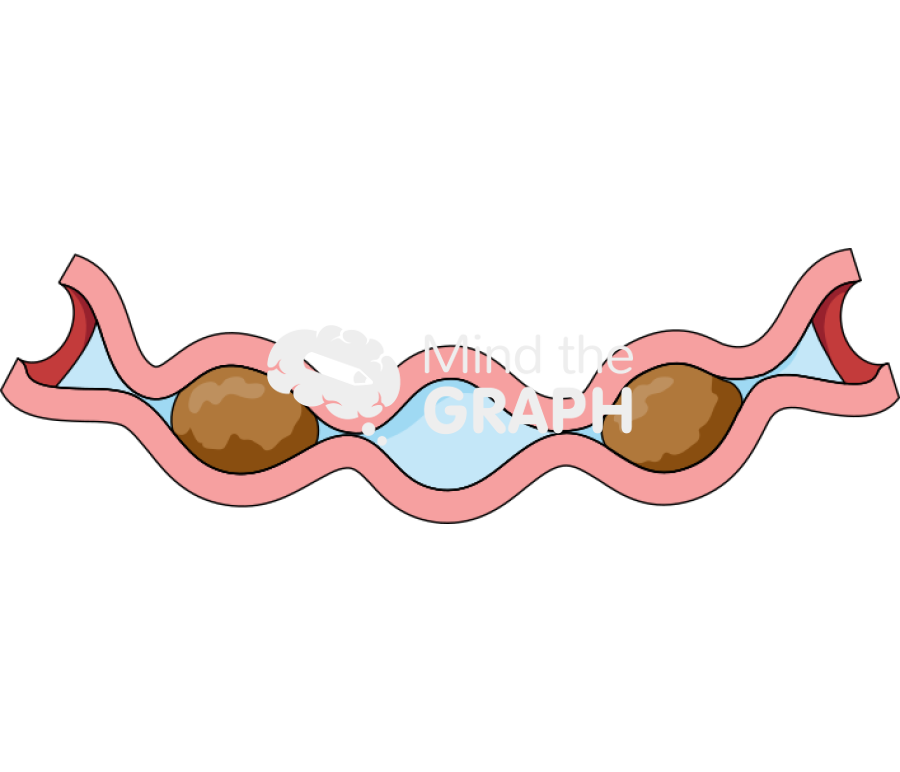 Intestine segmentation 1 Icons, Symbols, Pictures, and Images