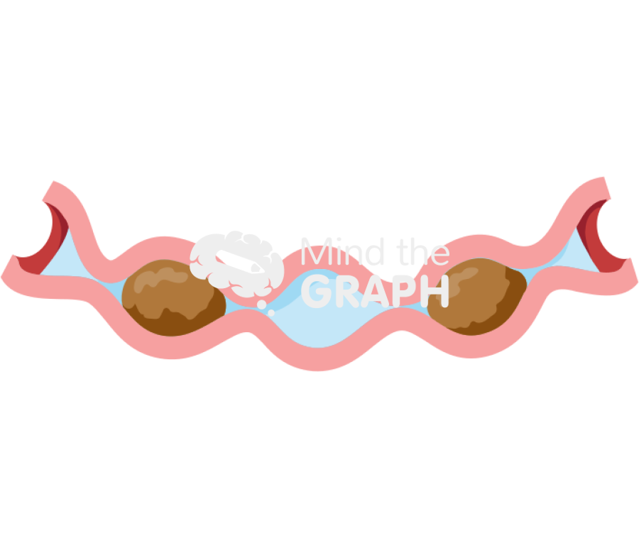 Intestine segmentation 1 Icons, Symbols, Pictures, and Images