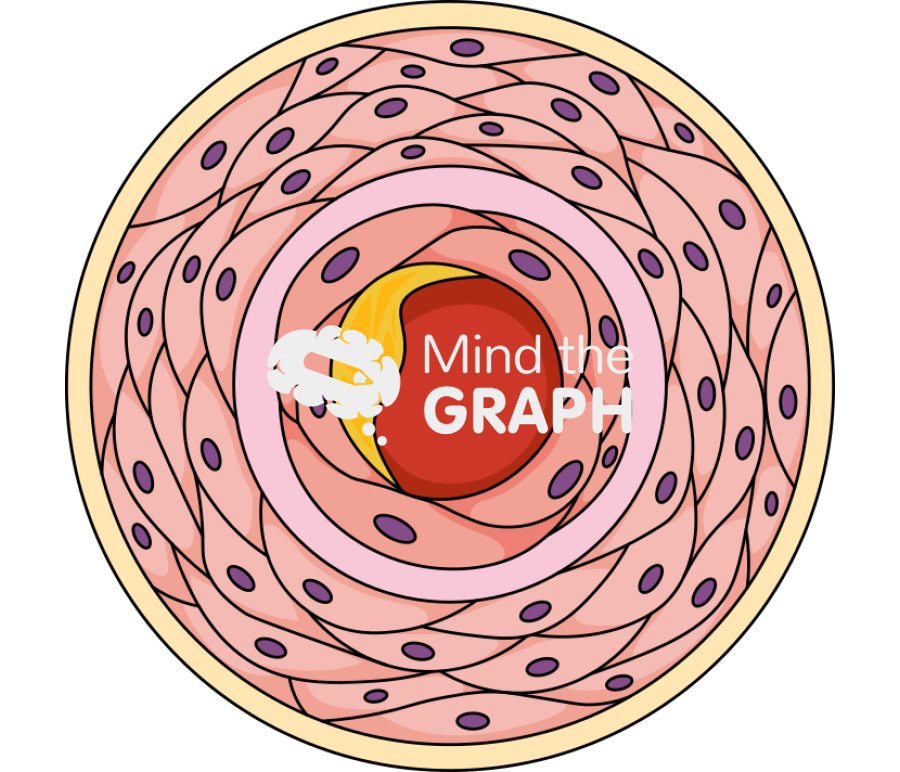 Intimal calcification Icons, Symbols, Pictures, and Images