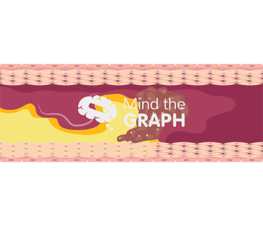 Intimal dissection 2 Icons, Symbols, Pictures, and Images