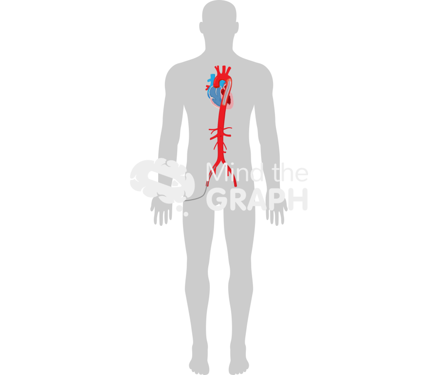 Intraaortic balloon pump heart body shape Icons, Symbols, Pictures, and Images