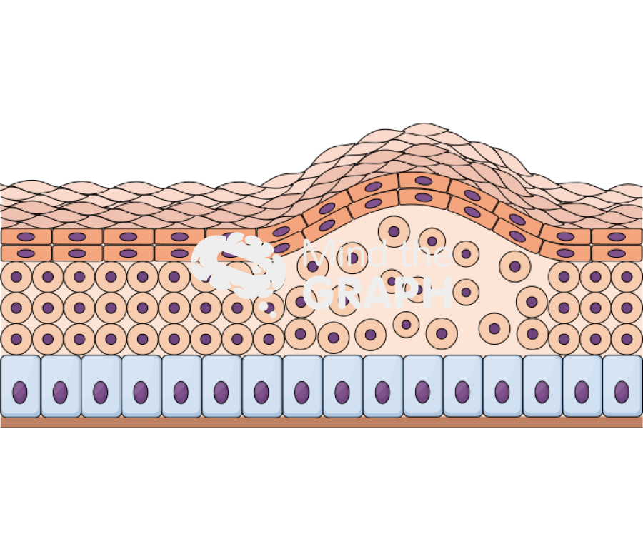 Intraepidermal blister skin Icons, Symbols, Pictures, and Images